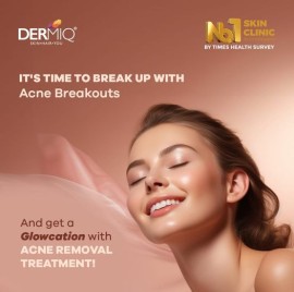 Acne Scar Treatment in Hyderabad, Jubilee Hills, India