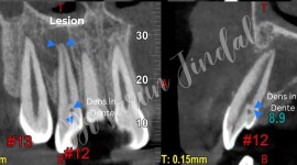 How to Evaluate Dental Services in Panchkula?, Panchkula, India